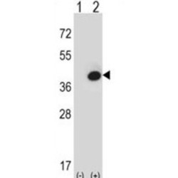 Fructose-1,6-Bisphosphatase 1 (FBP1) Antibody