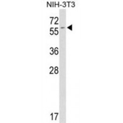 FK506 Binding Protein 9 (FKBP9) Antibody