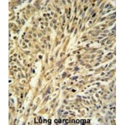 Inosine 5'-Monophosphate Dehydrogenase 2 (IMPDH2) Antibody