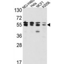 Inosine 5'-Monophosphate Dehydrogenase 2 (IMPDH2) Antibody