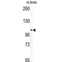 Tectonin Beta-Propeller Repeat-Containing Protein 1 (TECPR1) Antibody