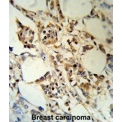 Putative RNA-Binding Protein 3 (RBM3) Antibody