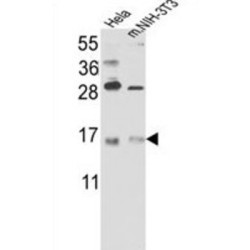 Putative RNA-Binding Protein 3 (RBM3) Antibody