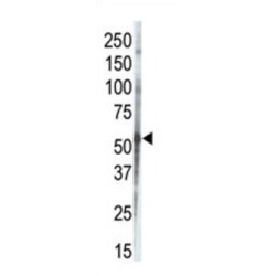 Casein Kinase I Isoform Gamma-3 (CSNK1G3) Antibody