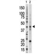 Serine/threonine-Protein Kinase VRK1 (VRK1) Antibody