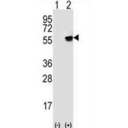 Serine/threonine-Protein Kinase VRK1 (VRK1) Antibody