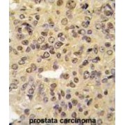 Menin (MEN1) Antibody