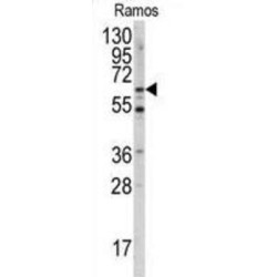 Menin (MEN1) Antibody