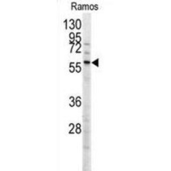 Menin (MEN1) Antibody