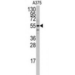 Caveolae-Associated Protein 1 (CAVIN1) Antibody