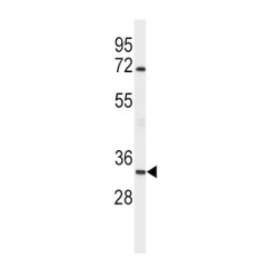 Apolipoprotein D (APOD) Antibody