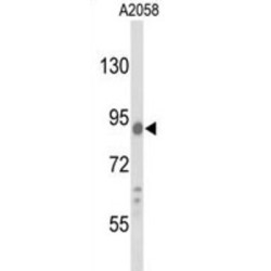 Conserved Oligomeric Golgi Complex Subunit 4 (COG4) Antibody