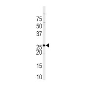 Sprouty RTK Signaling Antagonist 4 (SPRY4) Antibody