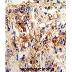 Cytochrome P450 2J2 (CYP2J2) Antibody