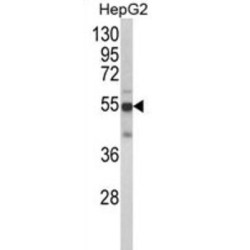 Cytochrome P450 2J2 (CYP2J2) Antibody