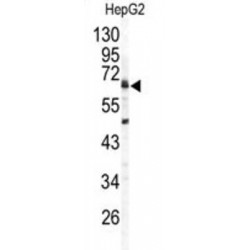 Arylsulfatase B (ARSB) Antibody