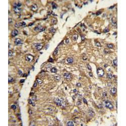 Vitronectin (VTN) Antibody