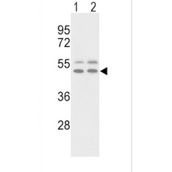 Vitronectin (VTN) Antibody