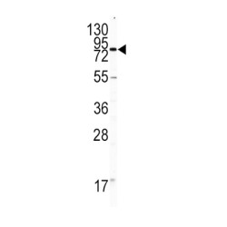 Platelet And Endothelial Cell Adhesion Molecule 1 (PECAM1) Antibody