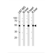 Alanine Aminotransferase 1 (GPT) Antibody