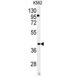 Osteomodulin (OMD) Antibody