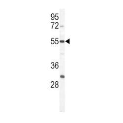 Pyruvate Kinase PKM (PKM1) Antibody