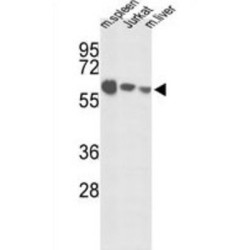 Insulin Like Growth Factor Binding Protein, Acid Labile Subunit (IGFALS) Antibody