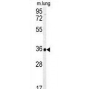 Carbonic Anhydrase 4 (CA4) Antibody