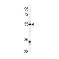 Growth Differentiation Factor 6 (GDF6) Antibody