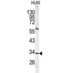 Capping Protein (Actin Filament) Muscle Z-Line, Alpha 1 (CAPZA1) Antibody