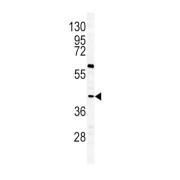 Growth Hormone Releasing Hormone Receptor (GHRHR) Antibody