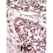 Mitogen-Activated Protein Kinase 3 / ERK1 (MAPK3) Antibody