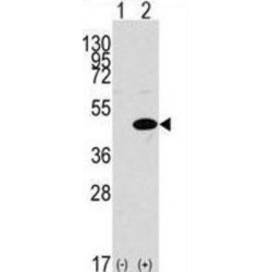 Mitogen-Activated Protein Kinase 3 / ERK1 (MAPK3) Antibody