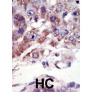 Mitogen-Activated Protein Kinase 9 / JNK2 (MAPK9) Antibody