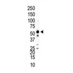 Mitogen-Activated Protein Kinase 9 / JNK2 (MAPK9) Antibody