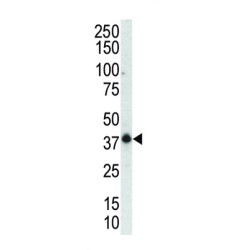 Mitogen-Activated Protein Kinase 12 (MAPK12) Antibody