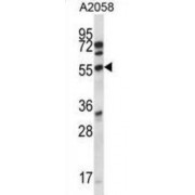 Amyotrophic Lateral Sclerosis 2 Chromosomal Region Candidate Gene 7 Protein (ALS2CR7) Antibody