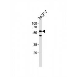 Cell Division Cycle Protein 7 (CDC7) Antibody