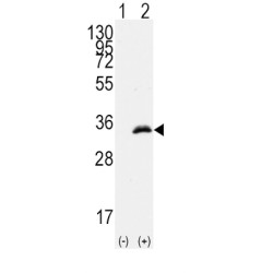 Cyclin-Dependent Kinase 1 (CDK1) Antibody