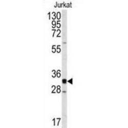 Cyclin-Dependent Kinase 2 (CDK2) Antibody