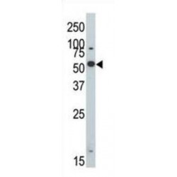 Dual Specificity Tyrosine-Phosphorylation-Regulated Kinase 2 (DYRK2) Antibody