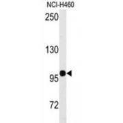 Homeodomain Interacting Protein Kinase 2 (HIPK2) Antibody