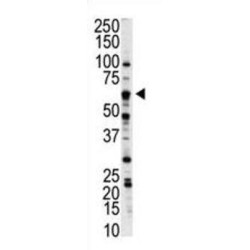 Serine/threonine-Protein Kinase NLK (NLK) Antibody