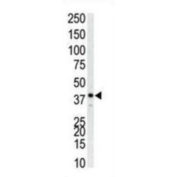 Mitogen-Activated Protein Kinase 14 (MAPK14) Antibody