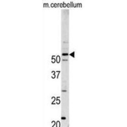 Cyclin-Dependent Kinase 14 (PFTK1) Antibody