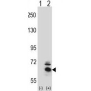 Bardet-Biedl Syndrome 4 Protein (BBS4) Antibody
