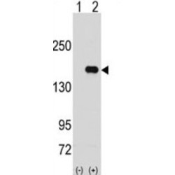 Pumilio RNA Binding Family Member 2 (PUM2) Antibody