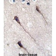 Pumilio Homolog 1 (PUM1) Antibody