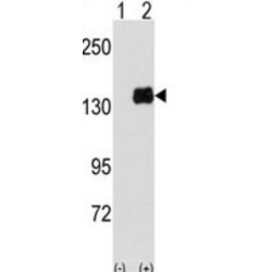 Pumilio Homolog 1 (PUM1) Antibody