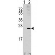 Ras Related C3 Botulinum Toxin Substrate 1 (RAC1) Antibody
